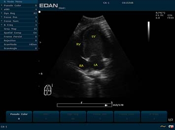 EDAN U2 VET