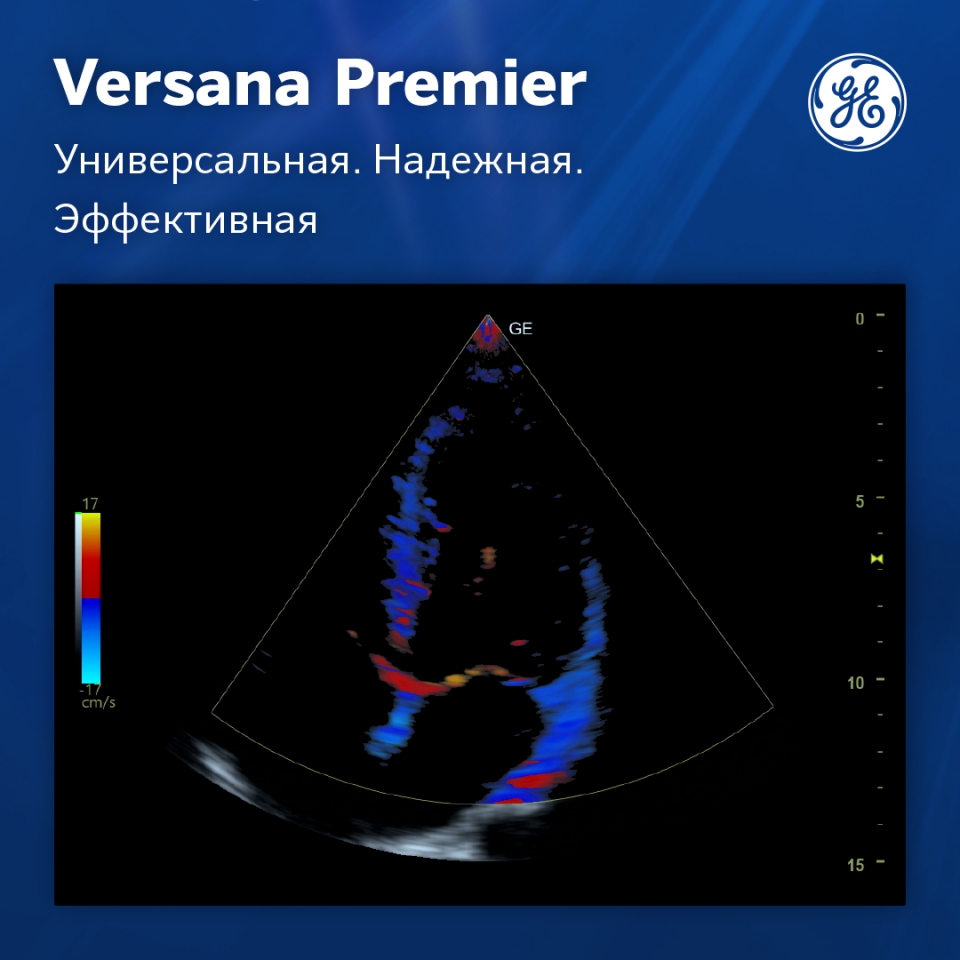 GE Versana Premier black