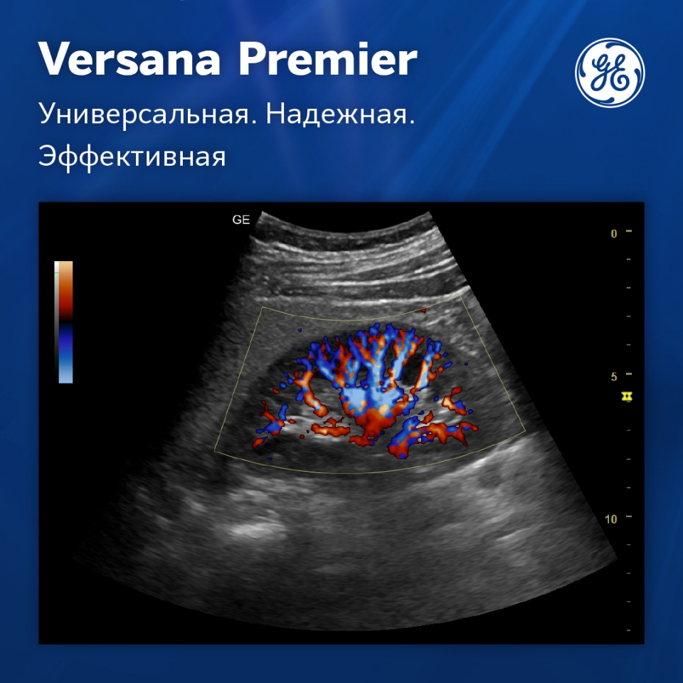 GE Versana Premier black