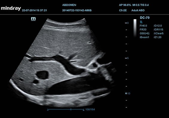 Mindray DC-60