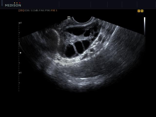 Samsung SonoAce R7