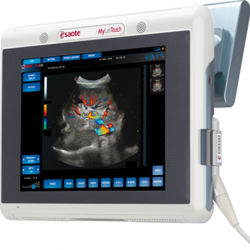 Esaote MyLab One